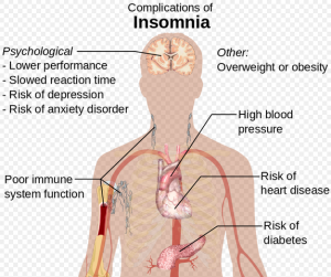 Insomnia complications can impact the brain, organs and immune system.  Illustration courtesy Häggström, Mikael. "Medical"