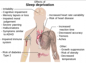 Effects of sleep deprivation